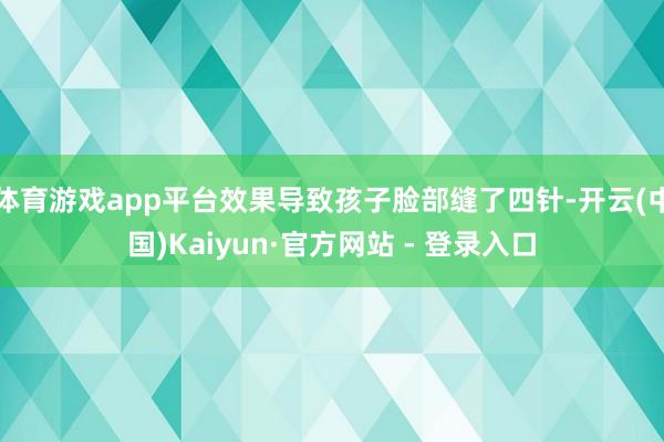 体育游戏app平台效果导致孩子脸部缝了四针-开云(中国)Kaiyun·官方网站 - 登录入口